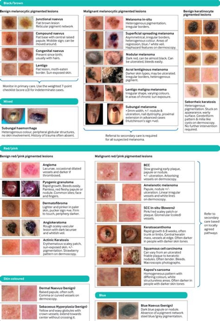 Are cystic lesions dangerous?
