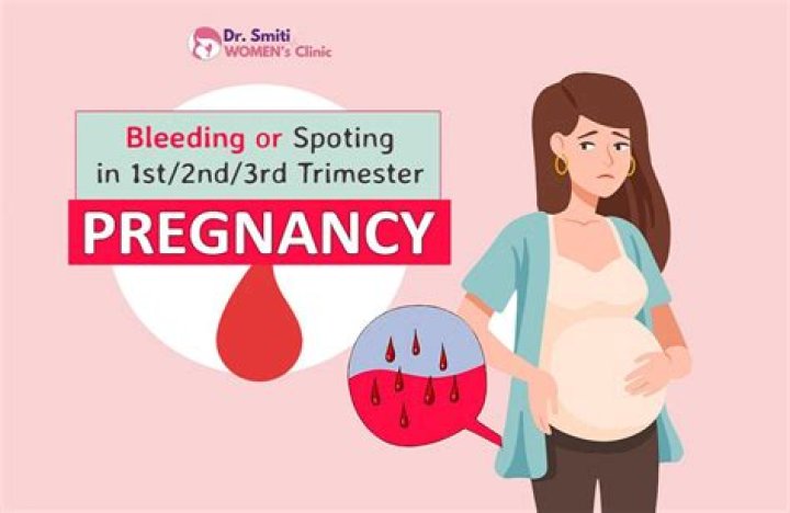 Are nosebleed a sign of pregnancy?