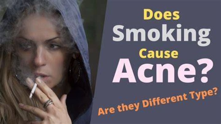 Can cigarettes cause acne?