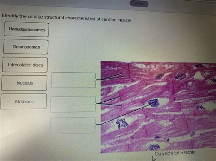 Can summation occur in cardiac muscle?