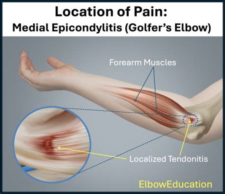 Could elbow pain be bone cancer?