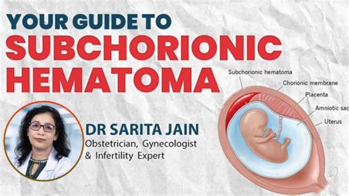 Does haematoma go away?