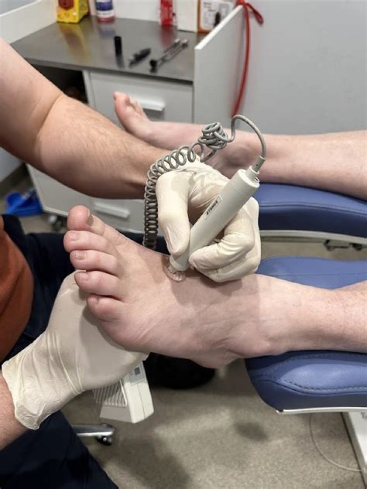 Does hawkeye call foot faults?