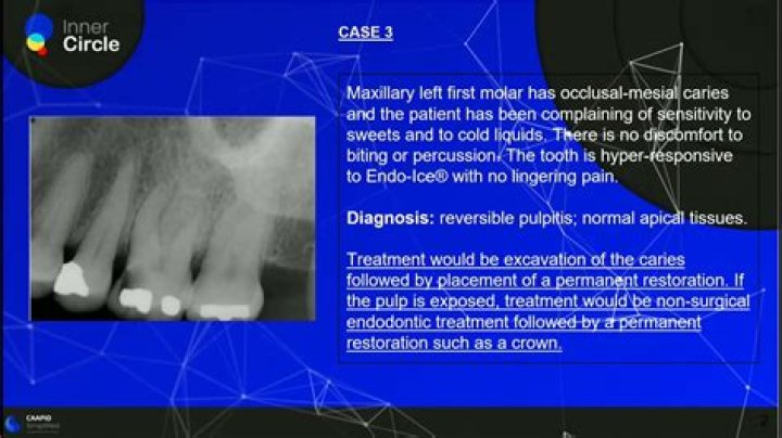 Does pulpitis show up on an x ray?