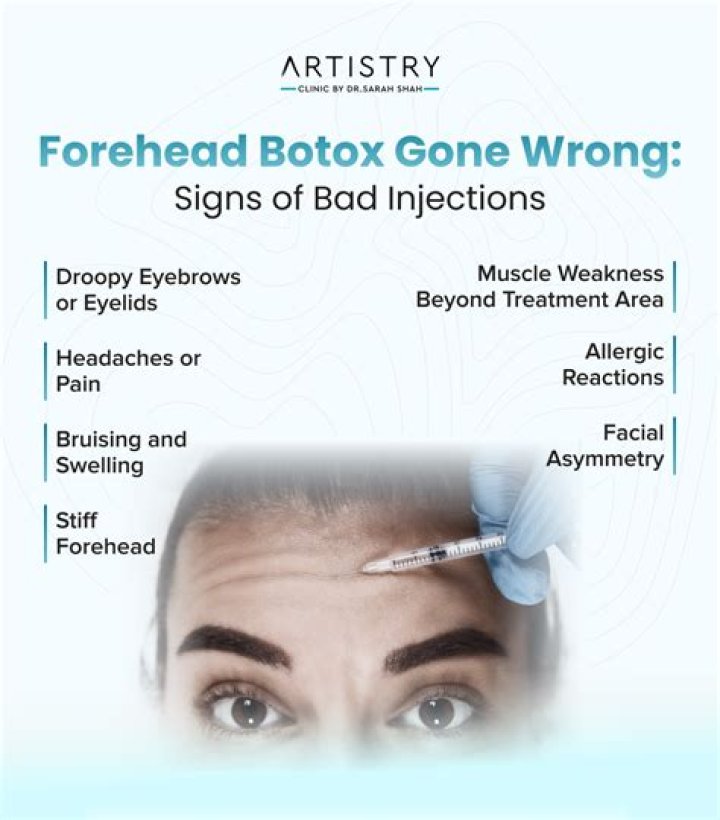 Has anyone died from botox injections?