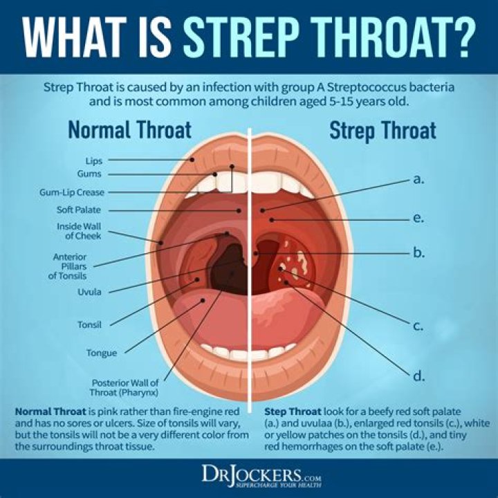 How to treat triatoma?