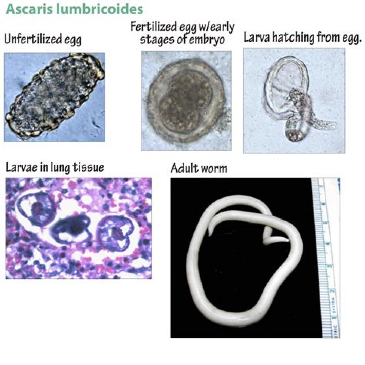 In ascaris lumbricoides respiration occurs through?