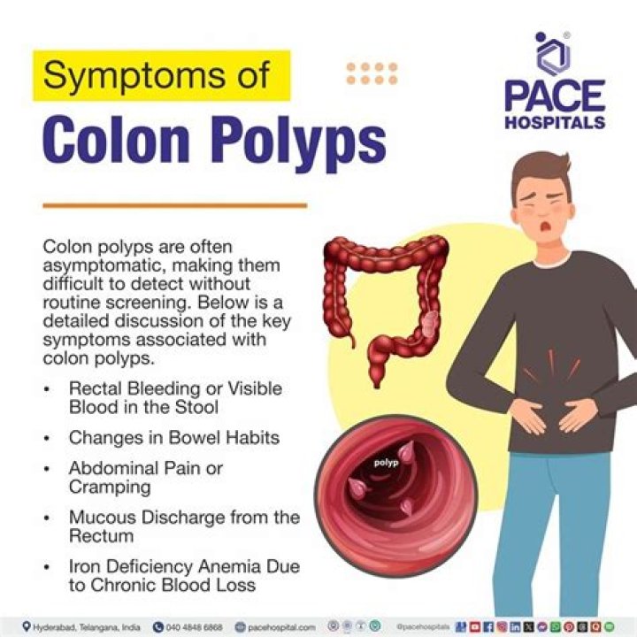 In the colon a polyp is a?