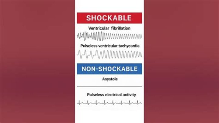 Is shockable and adjective?
