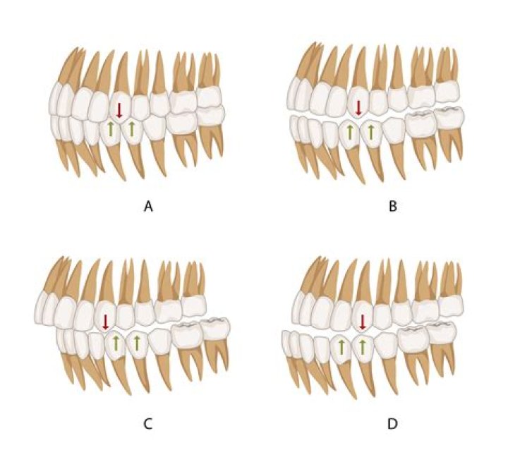 Should canine teeth be pointy?