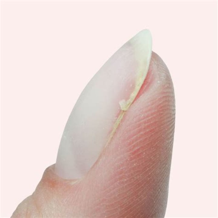 Should i tear off a broken nail?