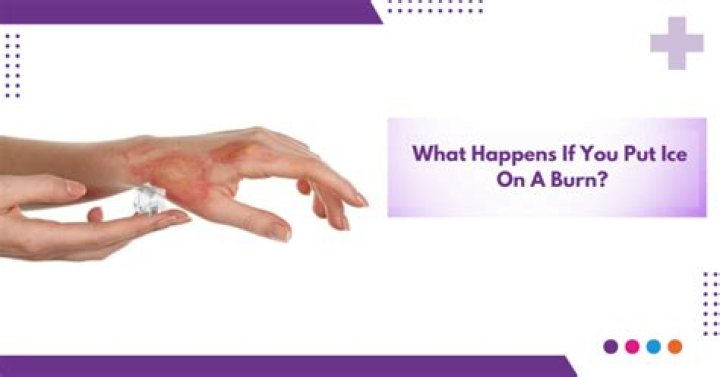 Should you put ice on a rattlesnake bite?