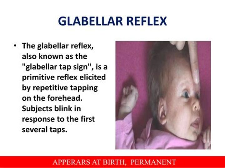 What is a normal glabellar reflex?
