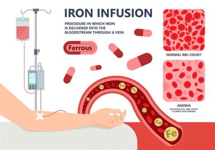 Where did transfusion originate?