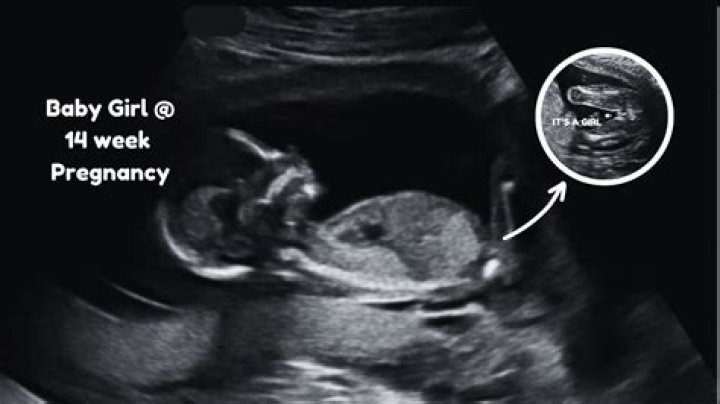 Where does baby sit at 14 weeks?