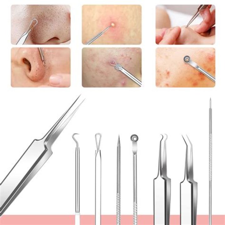 Where to remove blackheads?