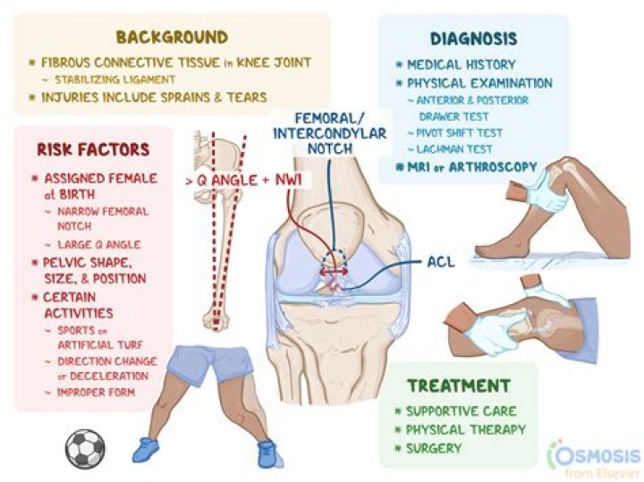 Which acl graft is best for athletes?