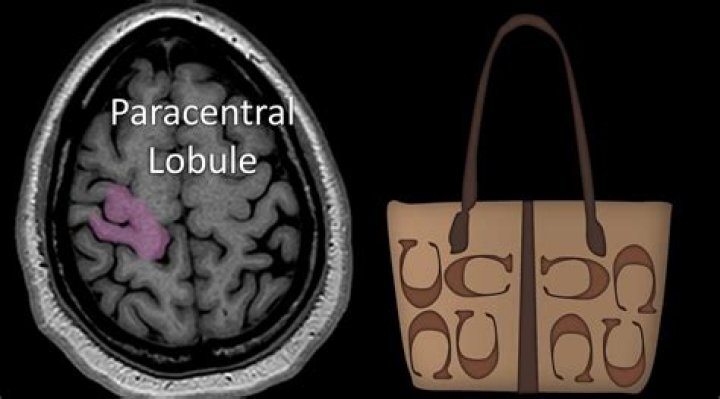 Which artery supplies paracentral lobule?