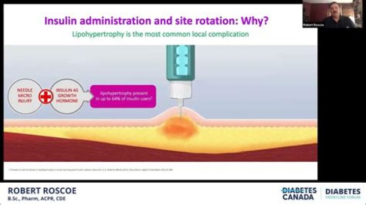 Why rotate insulin injection sites?