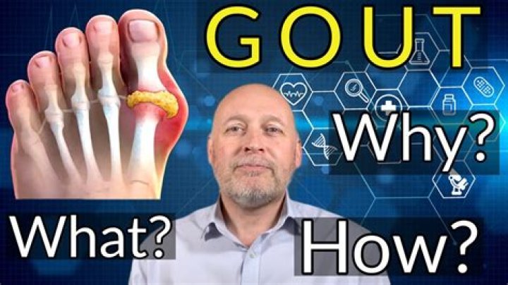 Will celebrex help gout?