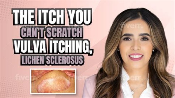 Will douching help with itching?