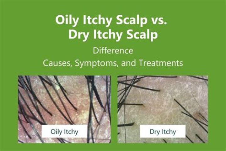 Will hair dye stick to oily hair?